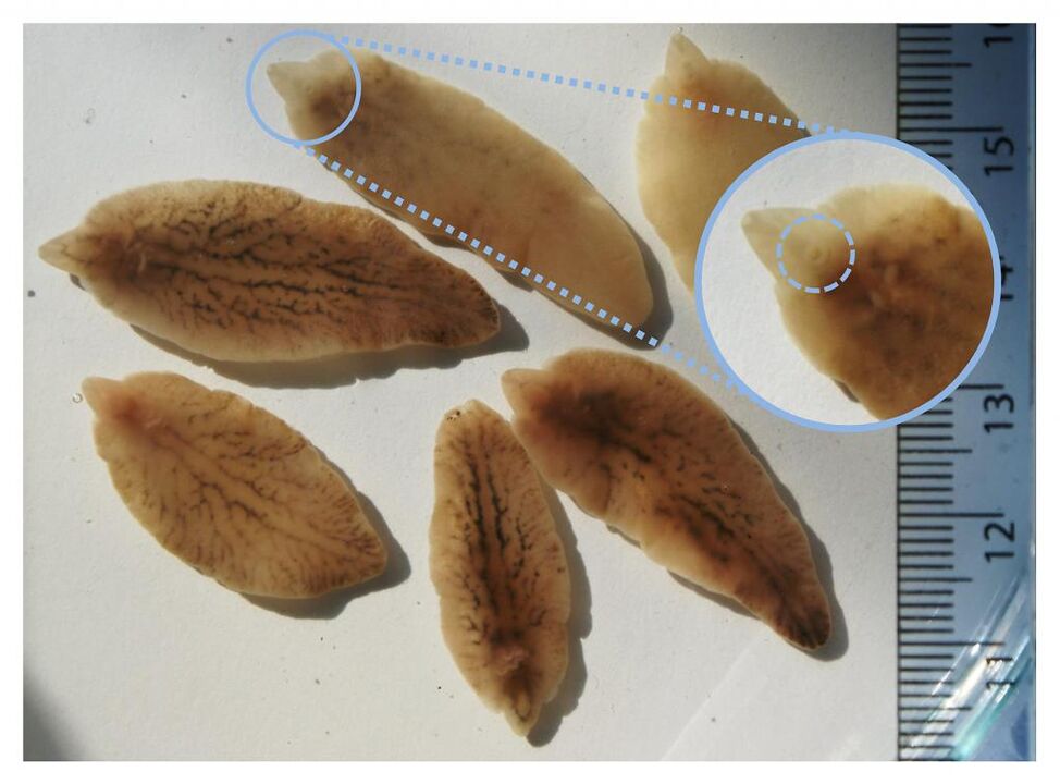Flukes liver