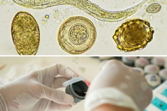 diagnostics of the presence of parasites in the body