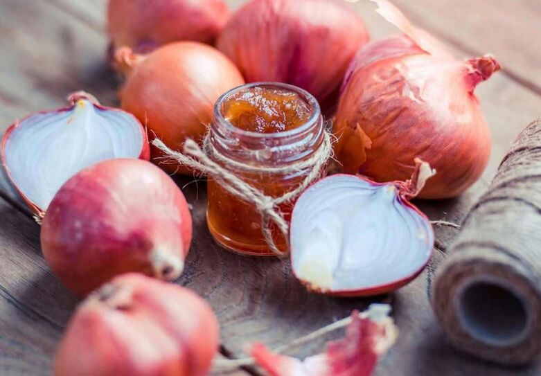 onions to get rid of parasites