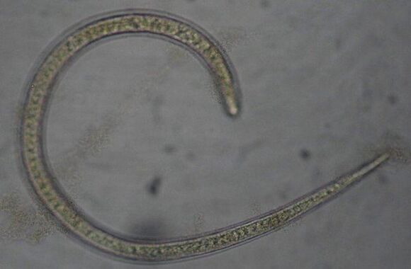 Trichinella is a protostome round parasitic worm