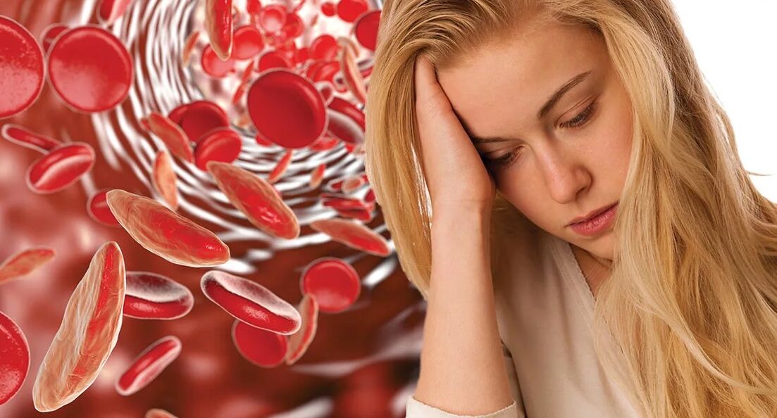 Anemia is caused by parasites