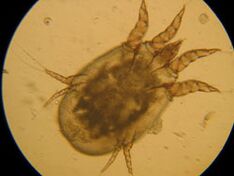 Mark under a microscope